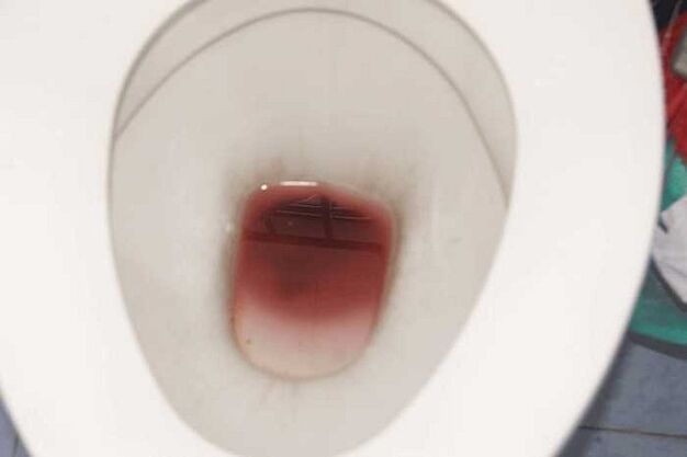 Spotting em homens quando eles estão excitados